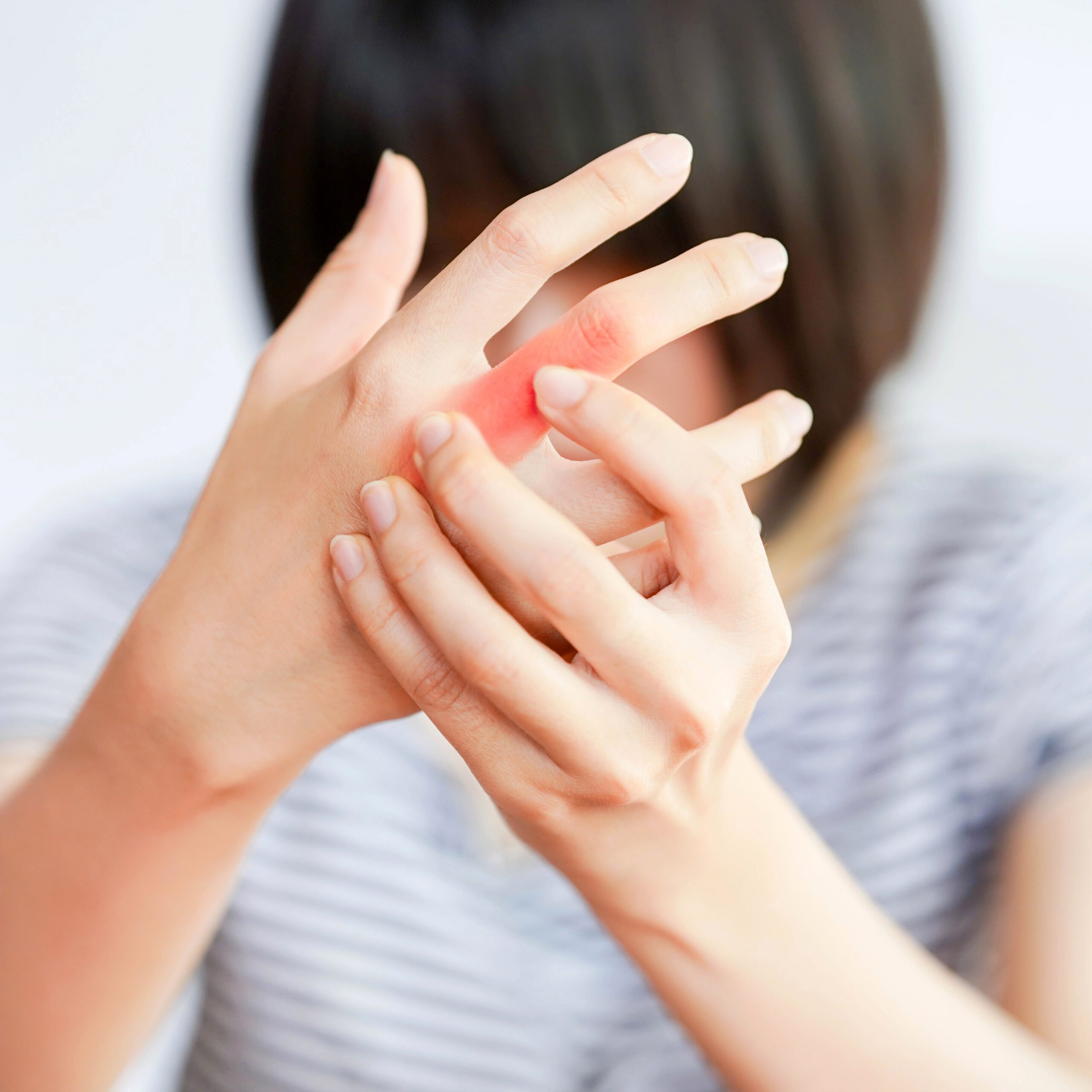 The image shows a person holding their hand and appearing to experience pain or discomfort in one of their fingers. The redness and swelling suggest inflammation, possibly due to conditions such as:</p>
<p>Rheumatoid arthritis</p>
<p>Osteoarthritis</p>
<p>Injury or strain</p>
<p>Tendonitis</p>
<p>Gout</p>
<p>If this image is being used for educational or promotional content, such as for an Ayurvedic treatment center, you could use a caption like:</p>
<p>"Don’t ignore persistent joint pain. Ayurveda offers natural solutions to relieve inflammation and restore mobility. Reclaim comfort the holistic way."</p>
<p>