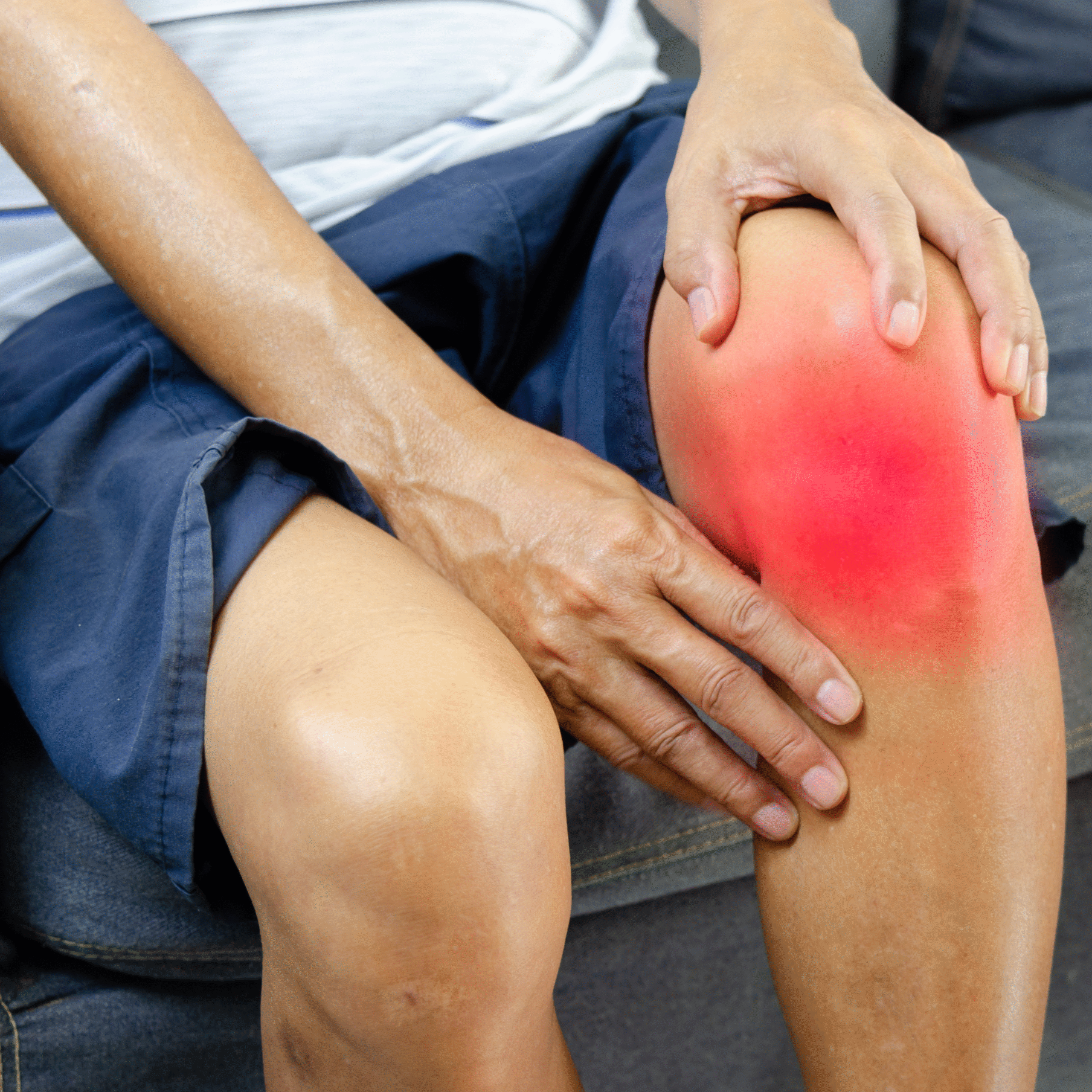 A person holding their inflamed and painful knee joint, visibly red and swollen, indicating symptoms of rheumatoid arthritis and joint pain.
