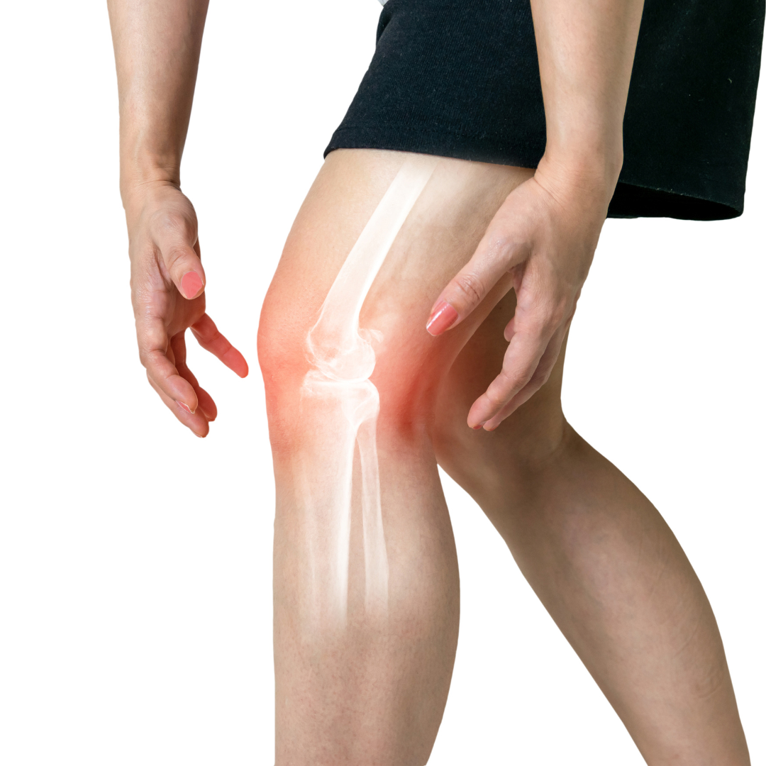Person holding a painful knee with redness and an overlaid X-ray view of the joint, illustrating inflammation and bone structure changes commonly associated with osteoarthritis.