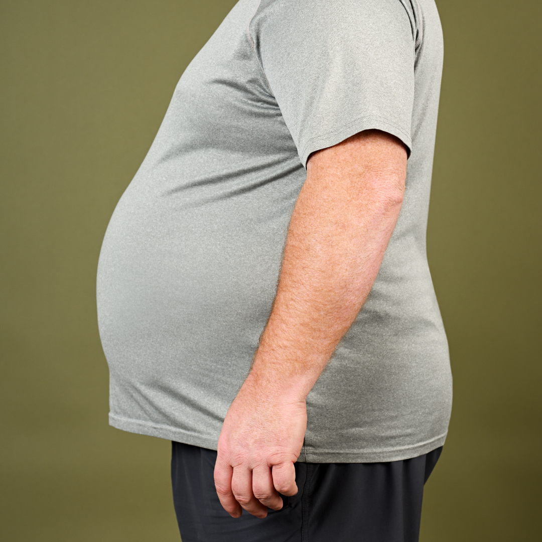 Side view of an overweight man with abdominal fat, wearing a grey t-shirt, representing obesity and weight management concerns.