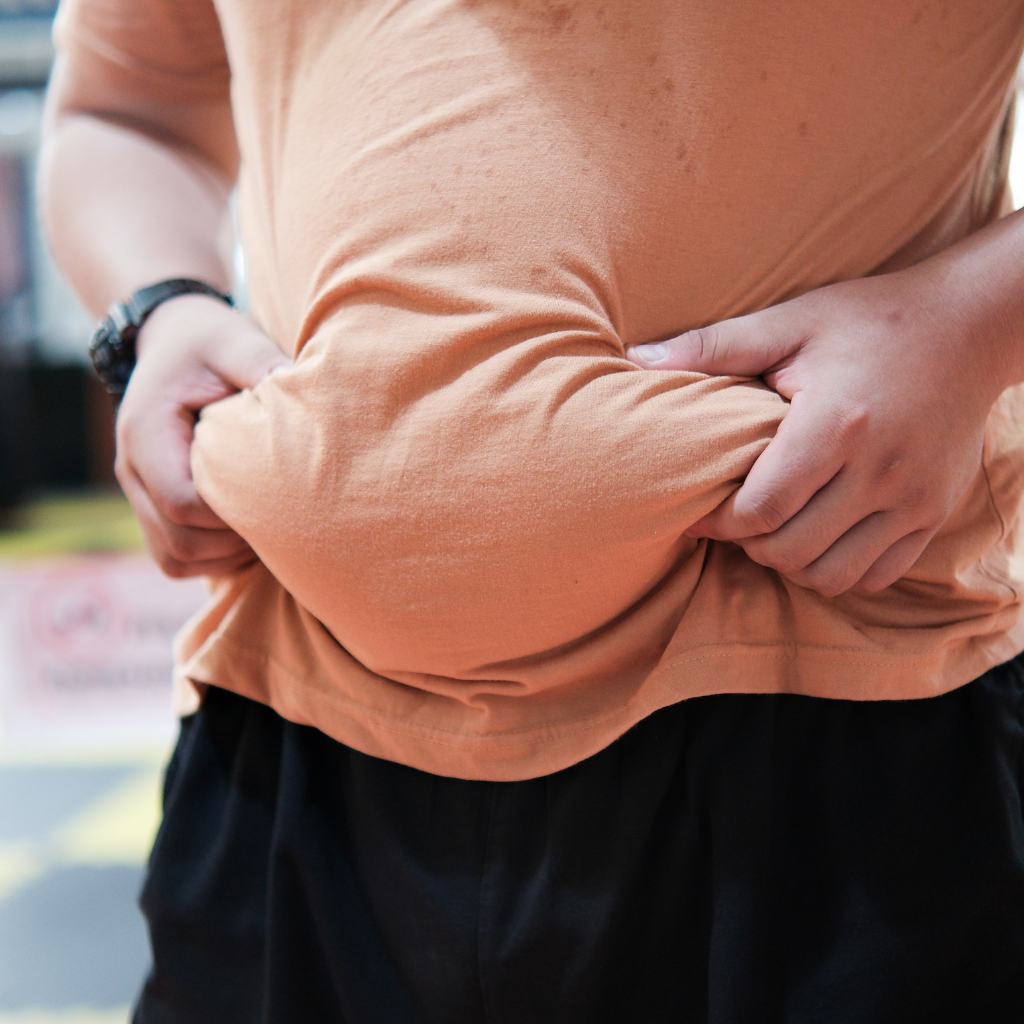 Person holding excess abdominal fat, representing obesity and belly fat concerns linked to lifestyle and metabolic imbalance.