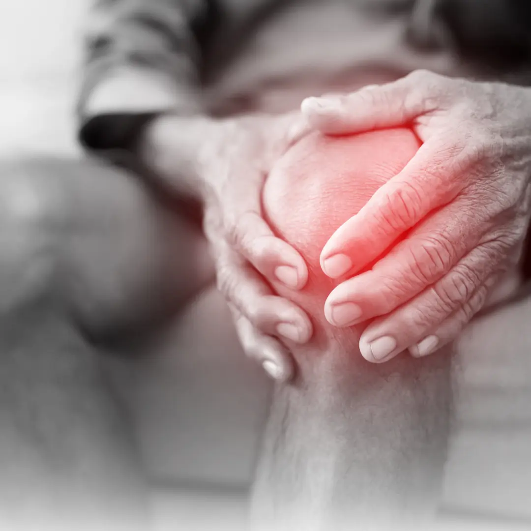 Ayurvedic Treatment for Osteoarthritis